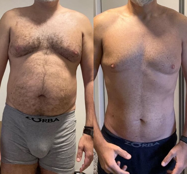 Antes e Depois