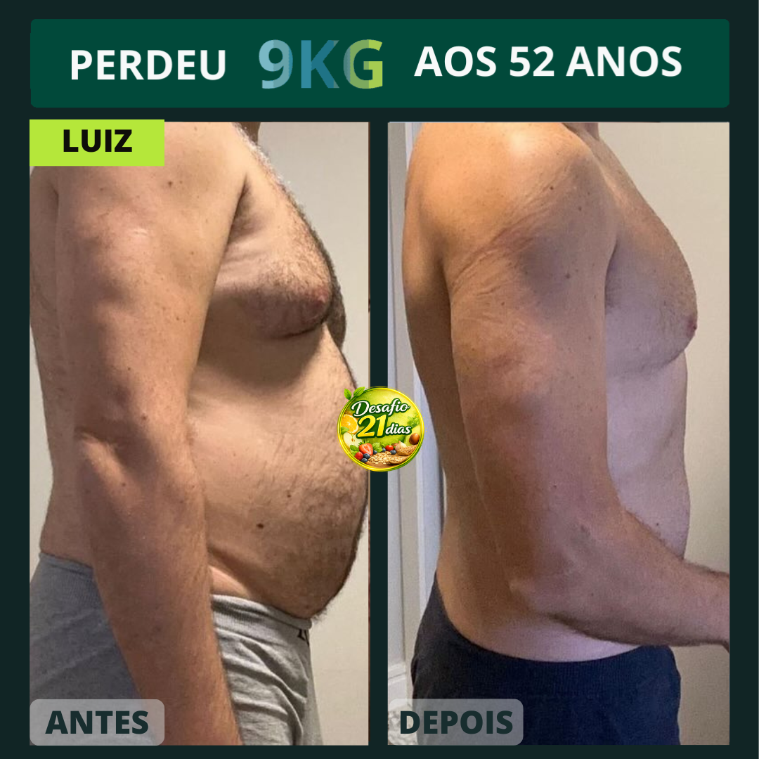 Antes e Depois 4